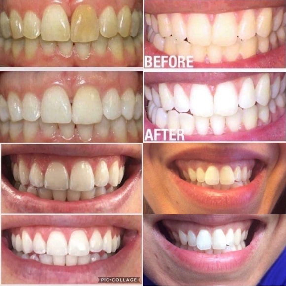 Whitening Toothpaste - Picture 6 of 9